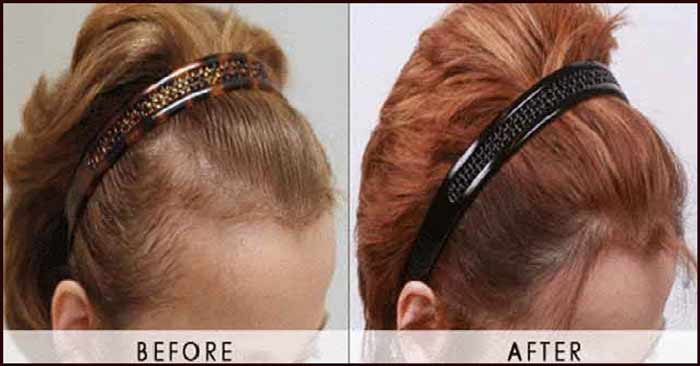 jojoba oil hair results-before and after
