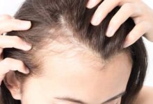 How to get rid of baby hair